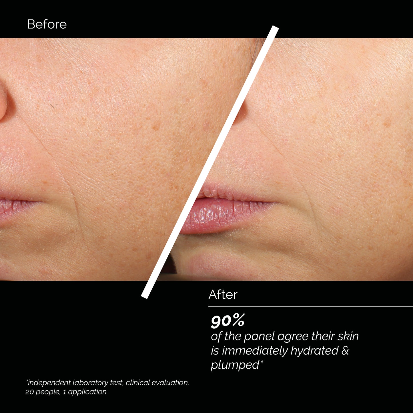 Skin Regimen Lx HA4 Jelly Serum